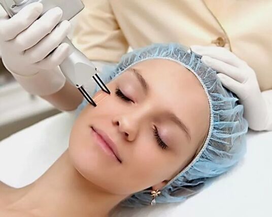 Veldlaser verjonging