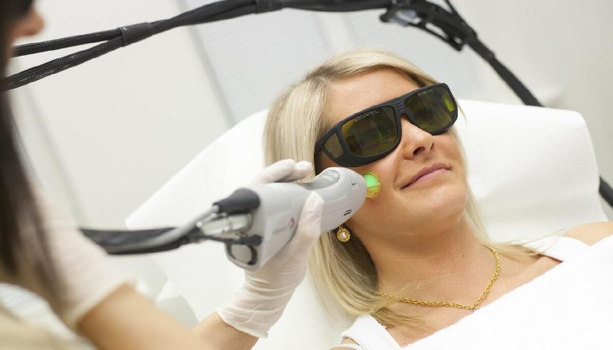 Laserverjonging