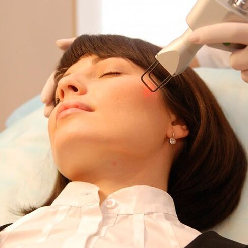 Veldlaser verjonging