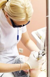 Een arts voert een fotothermolyseprocedure uit